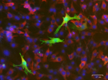 muscle cell hypertrophy